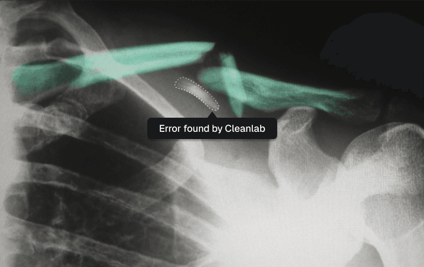 Overview of detecting errors in segmentation data with Cleanlab
